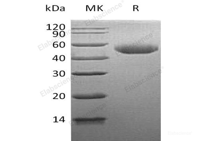 Recombinant Human α-Galactosidase/GLA Protein(C-6His)-Elabscience