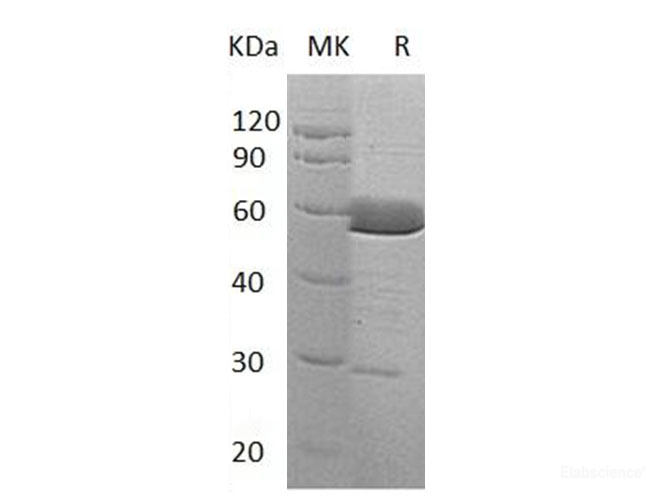 Recombinant Human α-Parvin/PARVA/MXRA2 Protein(C-6His)-Elabscience