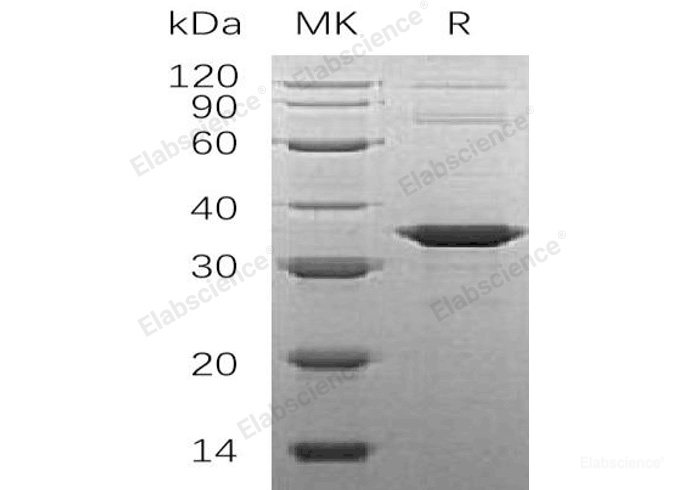 Recombinant Human α-Soluble NSF Attachment Protein/SNAP-α/NAPA Protein(N-6His)-Elabscience