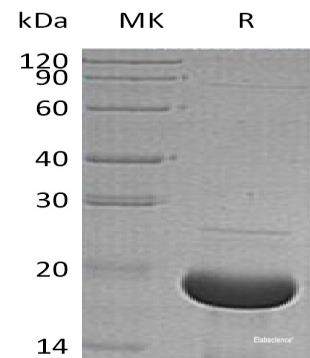 Recombinant Human α-Synuclein//SNCA Protein(N-6His)-Elabscience