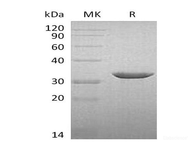 Recombinant Human β-1,3-Glucuronyltransferase 3/B3GAT3 Protein(C-6His)-Elabscience