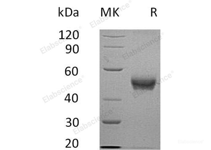 Recombinant Human β-1,4-Galactosyltransferase 3/B4GALT3 Protein(C-6His)-Elabscience