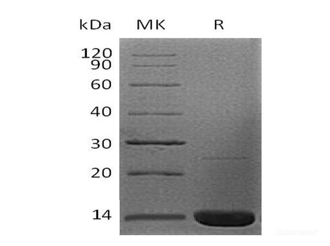 Recombinant Human β-2-Microglobulin/B2M Protein(N-6His)-Elabscience