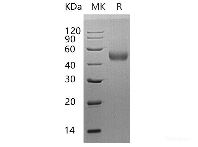 Recombinant Human β-Arrestin 1/ARRB1 Protein(C-6His)-Elabscience