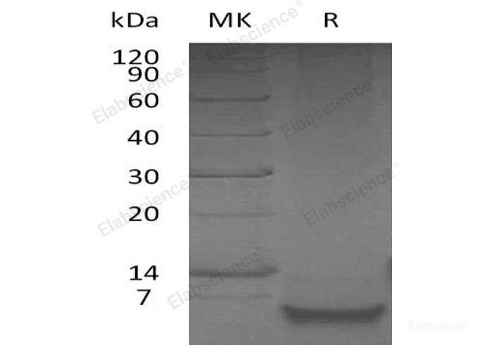 Recombinant Human β-Defensin 1/DEFB1 Protein-Elabscience