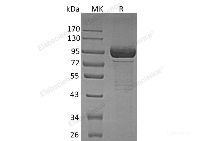 Recombinant Human β-Galactosidase/GLB1 Protein(C-6His)-Elabscience