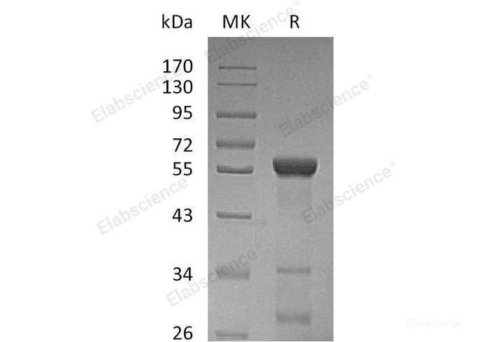Recombinant Human β-Lactamase-Like Protein 2/LACTB2 Protein(N-GST)-Elabscience