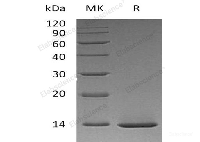 Recombinant Human β-Nerve Growth Factor/β-NGF(Ser122-Ala241, E. coli) Protein-Elabscience