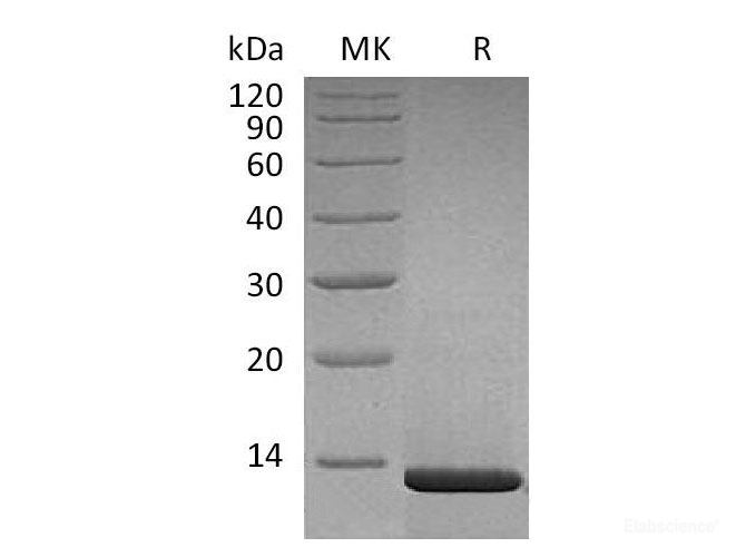 Recombinant Human β-Nerve Growth Factor/β-NGF(Ser122-Arg239, Cells) Protein-Elabscience