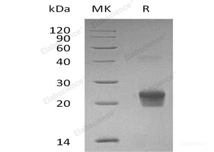Recombinant Human γ-Glutamylcyclotransferase/GGCT Protein(N-6His)-Elabscience