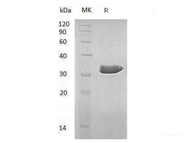 Recombinant Human δ(3,5)-δ(2,4)-Dienoyl-CoA Isomerase, Mitochondrial/ECH1 Protein-Elabscience