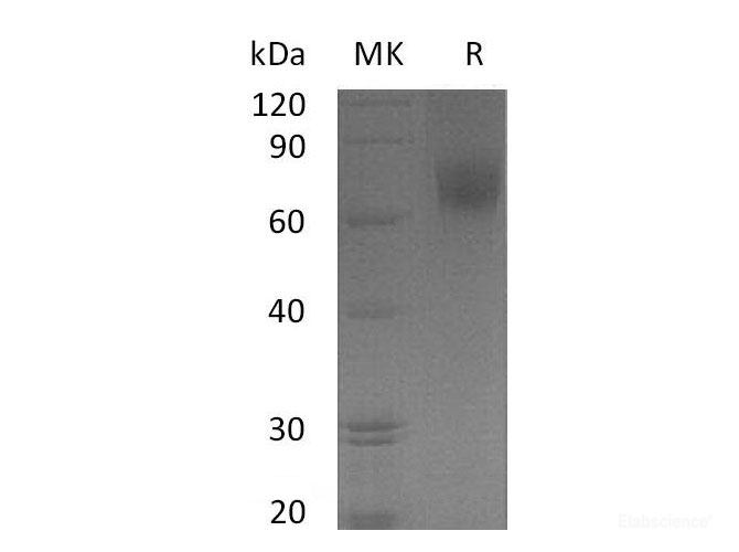 Recombinant Human Epidermal Growth Factor Receptor/Receptor Tyrosine Protein Kinase ErbB1 Protein-Elabscience