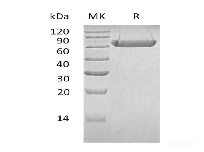 Recombinant Human Lymphocyte Activation Gene 3 Protein Protein-Elabscience