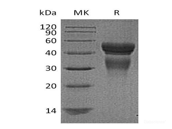 Recombinant Human Interleukin-12  Protein-Elabscience