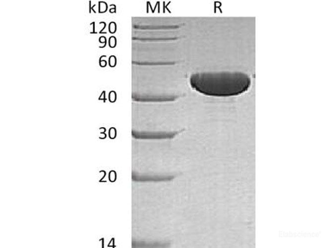 Recombinant Human Apolipoprotein A-IV Protein-Elabscience
