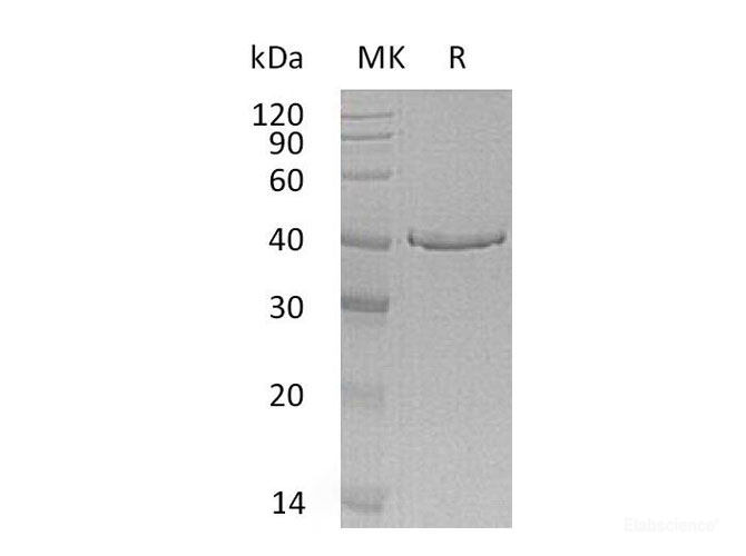 Recombinant Human GMP Reductase 1 Protein-Elabscience