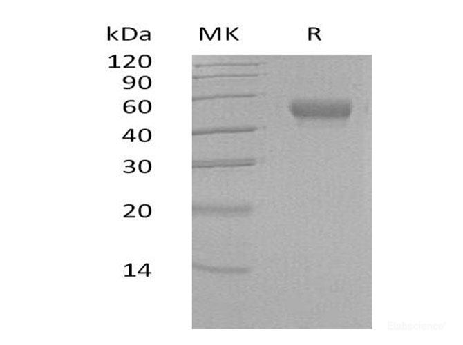 Recombinant Human Leucine-rich alpha-2-glycoprotein Protein-Elabscience
