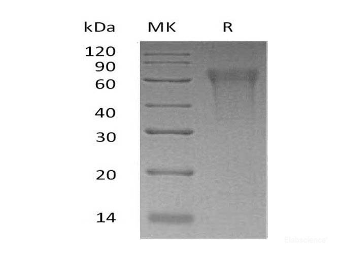 Recombinant Human CMRF35-Like Molecule 9 Protein-Elabscience