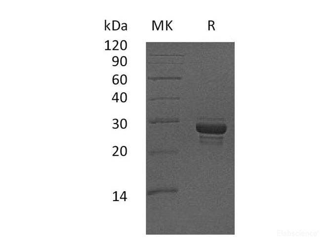Recombinant Human Calcitonin gene-related peptide 2 Protein-Elabscience