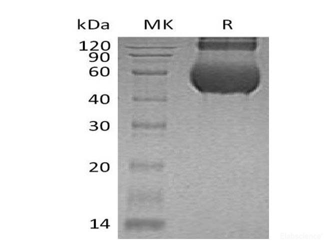 Recombinant Human CUB domain-containing protein 1 Protein-Elabscience