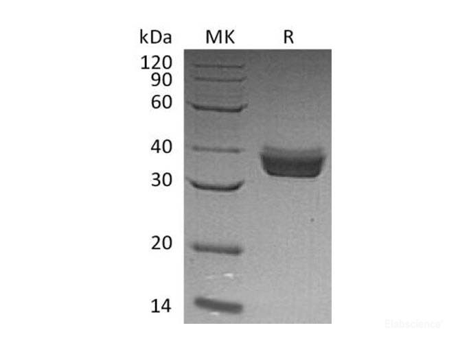 Recombinant Human Endoplasmic Reticulum Resident Protein 27 Protein-Elabscience