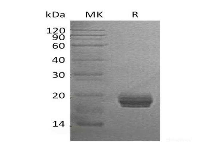 Recombinant Human Ganglioside GM2 activator Protein-Elabscience
