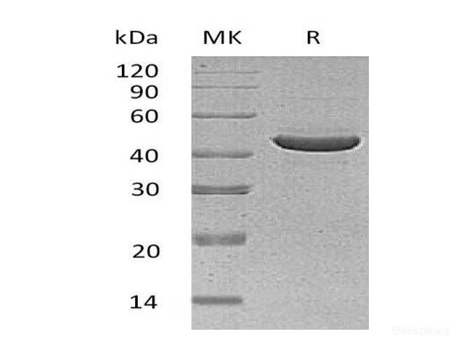 Recombinant Human Serine Protease Inhibitor-clade B3 Protein-Elabscience