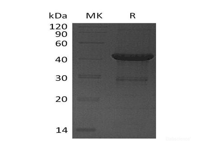 Recombinant Human Ubiquitin-Conjugating Enzyme E2 D4 Protein-Elabscience