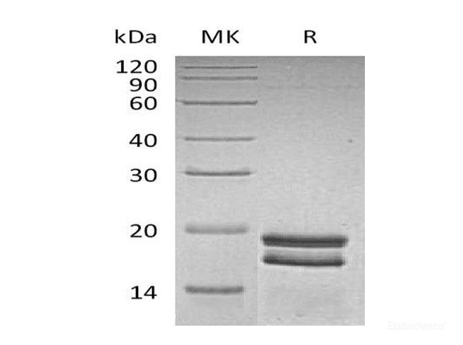 Recombinant Human Small Ubiquitin-Related Modifier 1 Protein-Elabscience