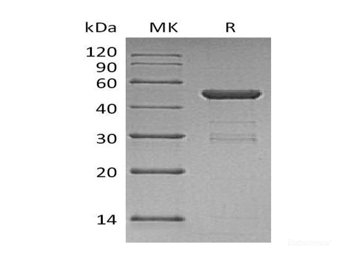 Recombinant Human Ubiquitin-Conjugating Enzyme E2 H Protein-Elabscience