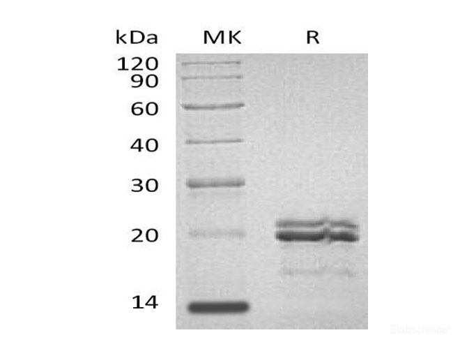 Recombinant Human Myc-Associated Factor X Protein-Elabscience