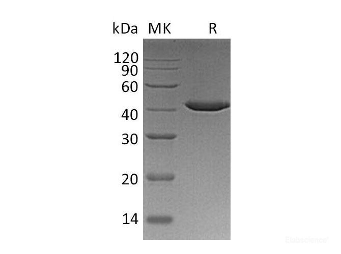 Recombinant Human Serine Protease Inhibitor-clade B9 Protein-Elabscience