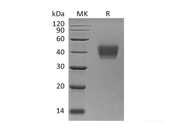 Recombinant Human killer cell immunoglobulin-like receptor 2DL3 Protein-Elabscience