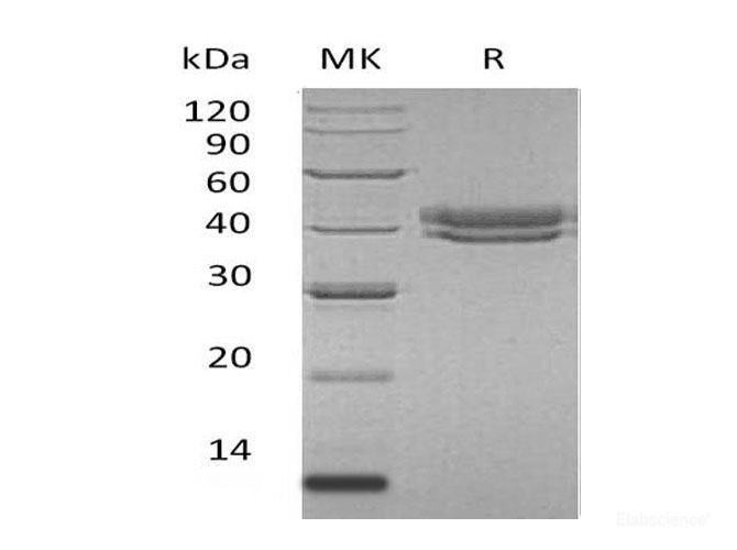 Recombinant Human Complement Factor H-Related 1 Protein-Elabscience