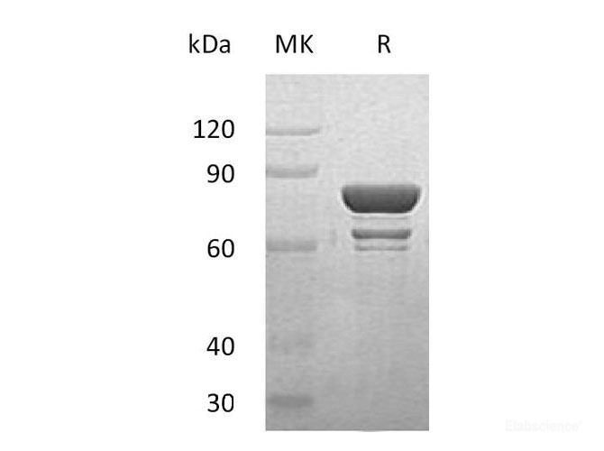 Recombinant Human Signal Transducer and Activator of Transcription 1 Protein-Elabscience