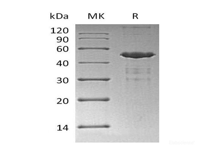 Recombinant Human Ubiquitin-Conjugating Enzyme E2 A Protein-Elabscience