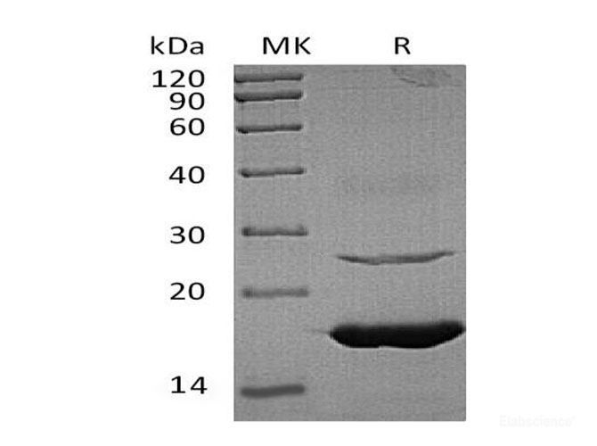 Recombinant Human Ubiquitin-Conjugating Enzyme E2 L6 Protein-Elabscience