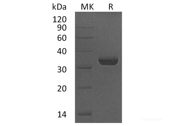Recombinant Human Vesicular Integral-Membrane Protein VIP36 Protein-Elabscience