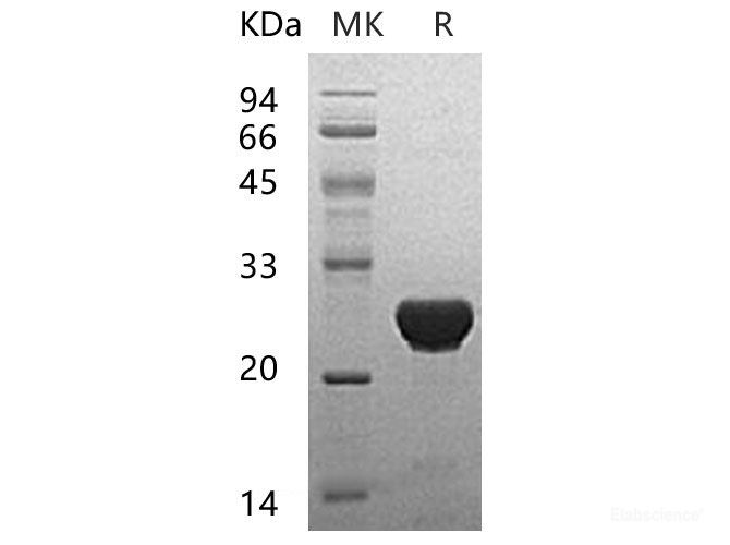Recombinant Human Ubiquitin-Conjugating Enzyme E2 T Protein-Elabscience