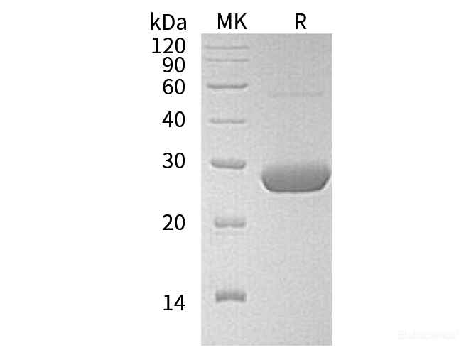 Recombinant Human Acyl-Protein Thioesterase 2 Protein-Elabscience