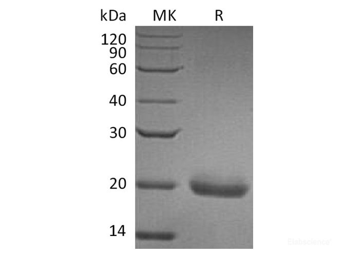 Recombinant Human Secreted and Transmembrane Protein 1 Protein-Elabscience