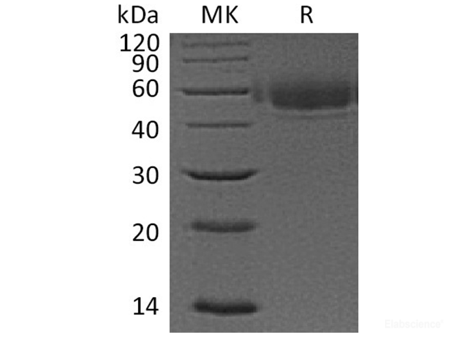 Recombinant Human V-Set and Immunoglobulin Domain-Containing Protein 4 Protein-Elabscience