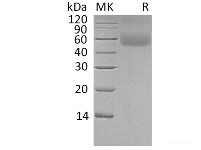 Recombinant Human Limbic system-associated membrane protein Protein-Elabscience