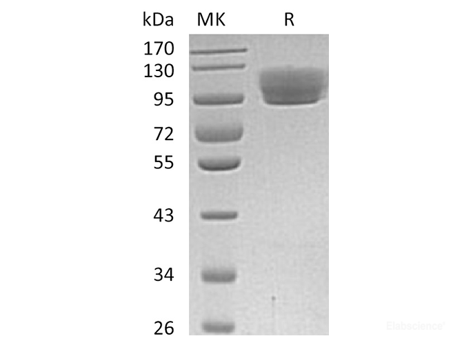Recombinant Human Roundabout homolog 4 Protein-Elabscience