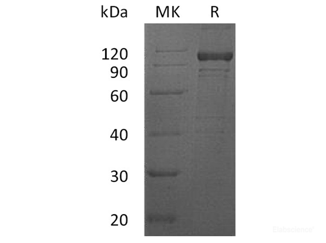 Recombinant Human Interleukin-12 receptor subunit beta-1 Protein-Elabscience