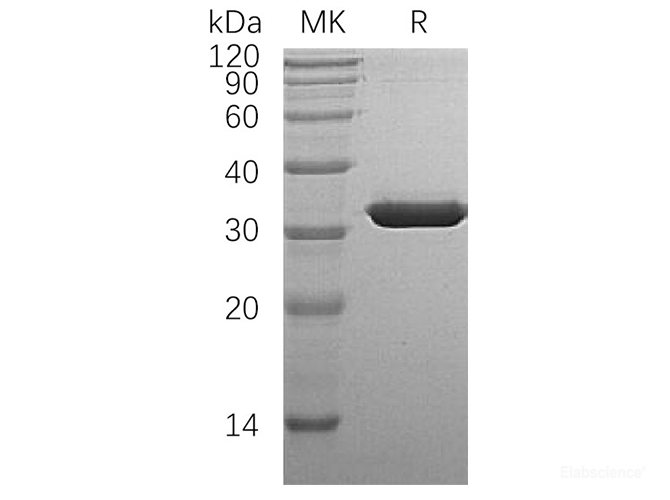 Recombinant Human Cytosolic Sulfotransferase Family 1A Member 1 Protein-Elabscience