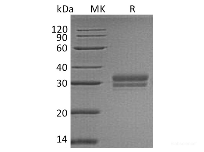 Recombinant Human V-Set and Immunoglobulin Domain-Containing Protein 2 Protein-Elabscience