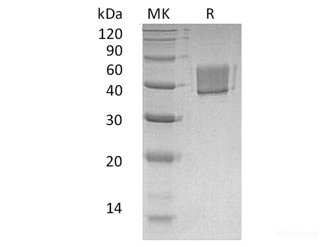 Recombinant Human Fc Receptor-Like Protein 1 Protein-Elabscience