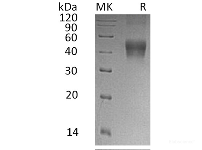Recombinant Human Interleukin-21 Receptor Protein-Elabscience