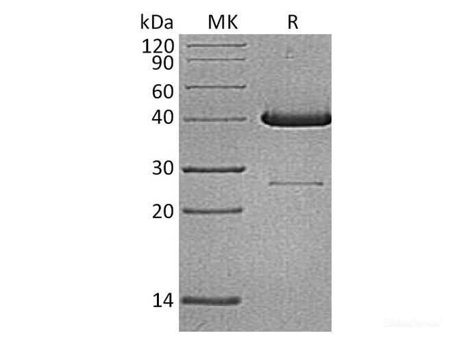 Recombinant Human Ubiquitin-conjugating enzyme E2 D1 Protein-Elabscience